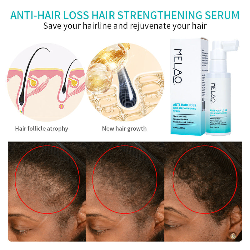 Minoxidil Hair Strengthening Serum